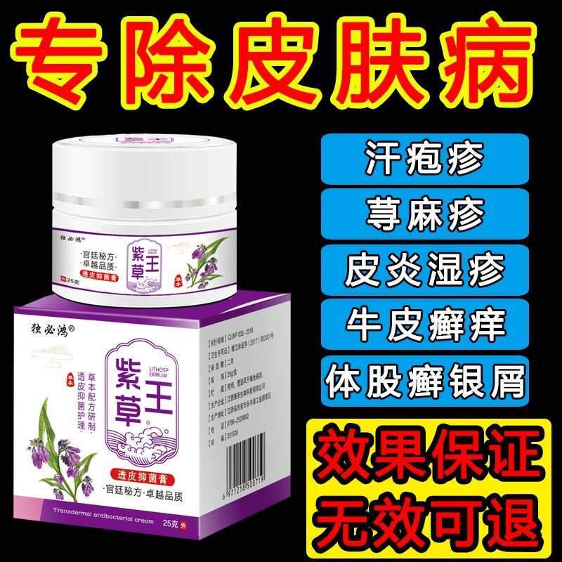 牛皮癣药膏