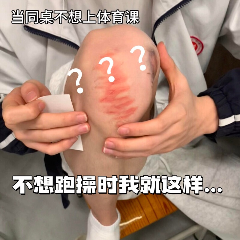 Wound Tattoo Stickers, Realistic Bruise Scar Stickers, Realistic 3D Waterproof Transfer Stickers, Student Prank Stickers for Teachers