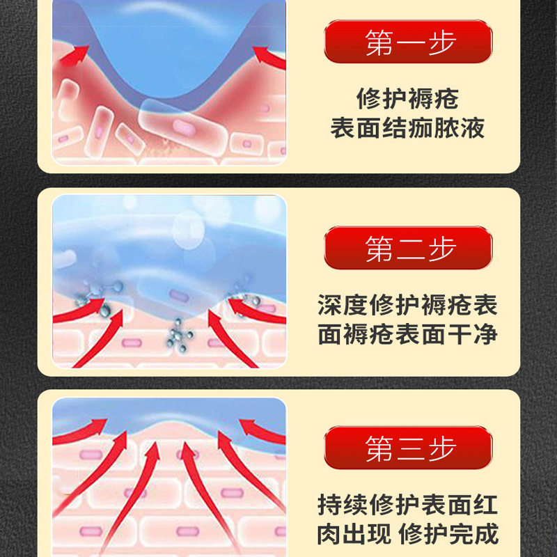 空洞型黑痂型压疮治疗新突破:促进伤口愈合的外用专用方案-户外应急装备-淘宝百科网