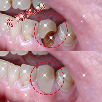 (Recommended by Dentists) Dissolve tartar stains and yellow teeth. Unisex. Developed in the United States.