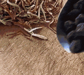009.gif