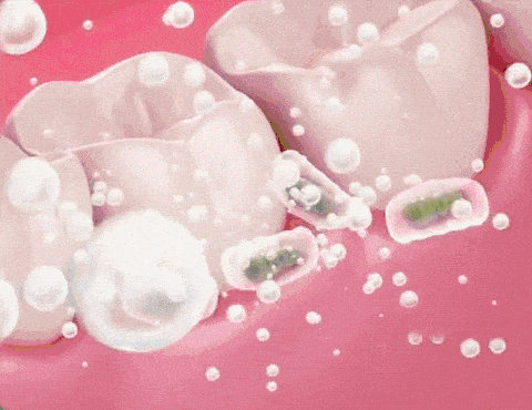 DM_20240718145819_014.gif