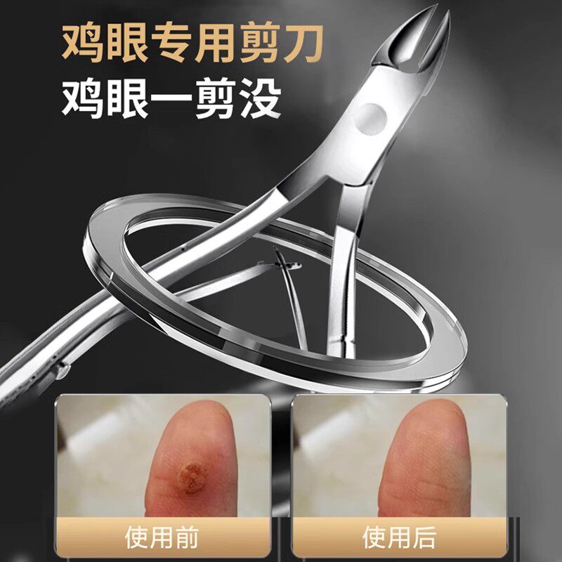 去除脚趾上老茧脚底跖疣挖修鸡眼剪刀工具修脚神器老茧专用剪刀治