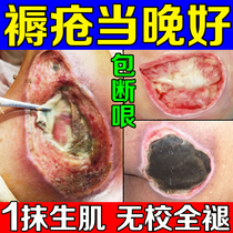 Decubitus wound healing promotes muscle growth special medicine medical skin removal and muscle regenerating cream special for the elderly with pressure sores and rotten legs