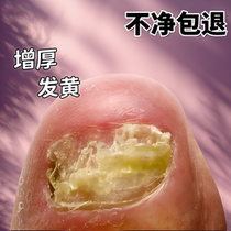 Tong Ren Tang sells NT$100000 no guarantee no repairs. One drop of it can painlessly remove bad potassium from your hands and toes without damaging the good potassium.