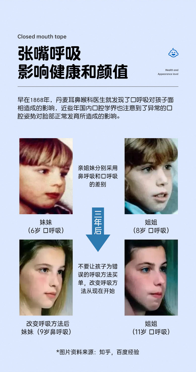 Анти-храп продукты 【口呼吸矫正贴】小孩闭口贴嘴巴闭合封贴防张口睡觉闭嘴贴 No brand