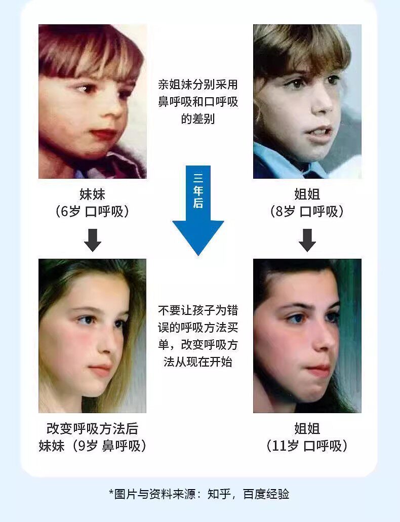 Анти-храп продукты 【口呼吸矫正贴】小孩闭口贴嘴巴闭合封贴防张口睡觉闭嘴贴 No brand