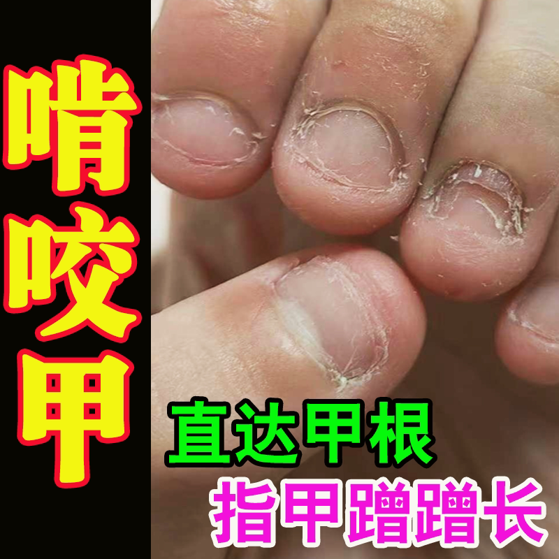 Nail Repair and Correction Solution for Deformed, Short, and Shrinking Nails; Uneven and Unevenly Shaped Fingernails