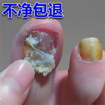 (Watsons best-selling) One drop of it can inhibit bacteria without removing nails and remove 99% of gray potassium fungi. If invalid return guarantee