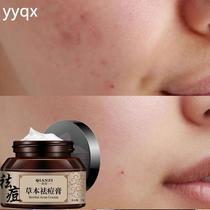 z Remove bean acne and acne cream to remove bean scars and acne for girls and boys herbal acne removal for junior high school girls