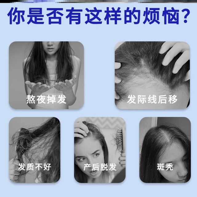 He Feng Wuyu Oil Official Flagship Fish Oil for Smooth Hair Care and Nourishment, Anti-Hair Loss for Adults, He Feng Wuyu Oil