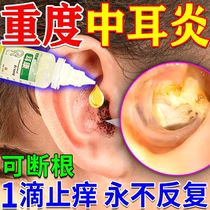 Ear anti-inflammatory ear drops ear itching anti-bacterial and anti-otitis medicine can get rid of buzzing deafness and tinnitus.