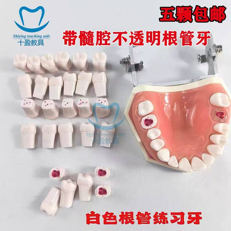 白色根管牙牙科开髓牙树脂教学模型口腔离体牙科考试练习开髓牙粒