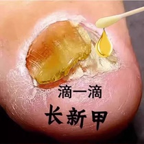 (Watson’s hot sale) One drop at a time no guarantee no repair no damage to your skin~ Buy 2 and get 1 free buy 3 and get 2 free