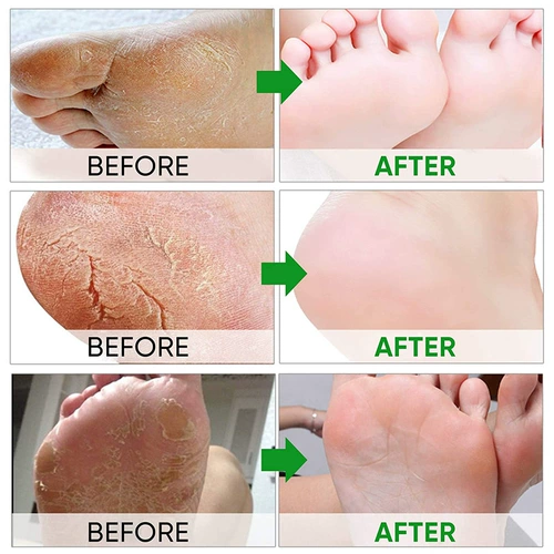 Маска для ног EFERRO «Лаванда» смягчает кератин.