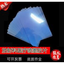 Medical film dry radiology printing film inkjet blue film dental fracture DRCR light MR magnetic resonance