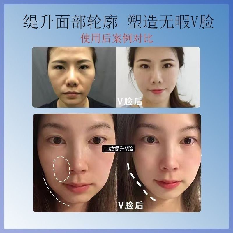 法令纹在哪个部位比较好？宝藏解答来了，建议收藏！