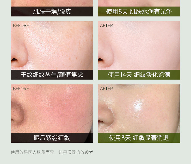SKIN GRAVITY奢润抗皱紧致精粹水乳7 — 17