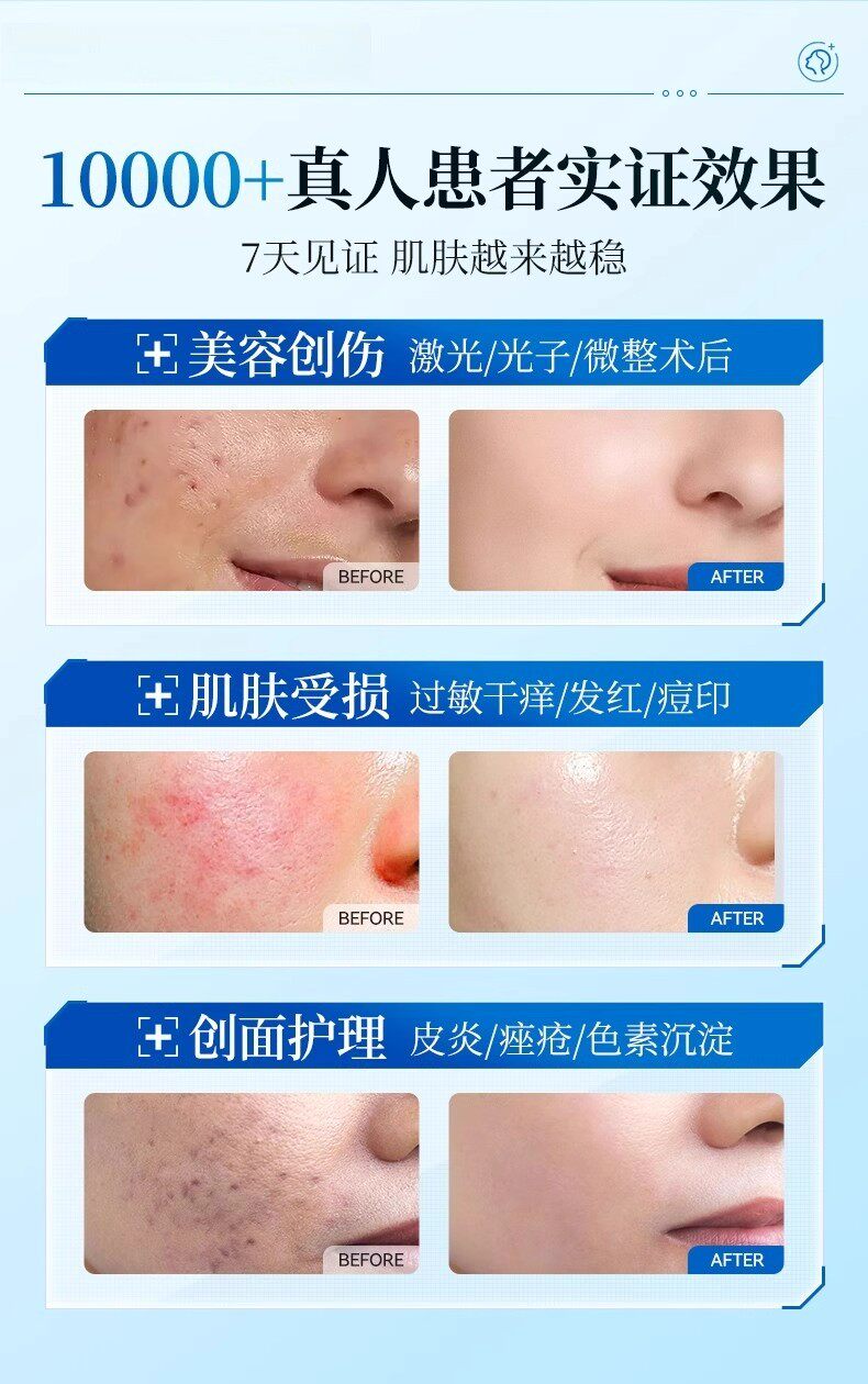 Recombinant Collagen Repair Dressing Medical Grade - Product image 7