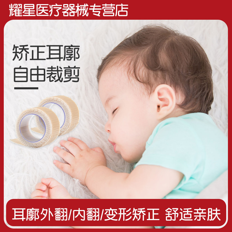 婴儿耳朵固定贴招风耳纠正器医用硅胶耳廓矫正贴胶带新生儿童宝宝