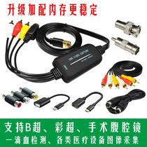Driver-free USB video capture card recording B-ultrasound color ultrasound medical equipment one drop of blood detection laparoscopy gastroscopy microscope