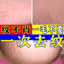 Stretch Marks Elimination Stretch Marks Firming Belly Firming Postpartum Growth Obesity Marks Repair Care Belly Ointment