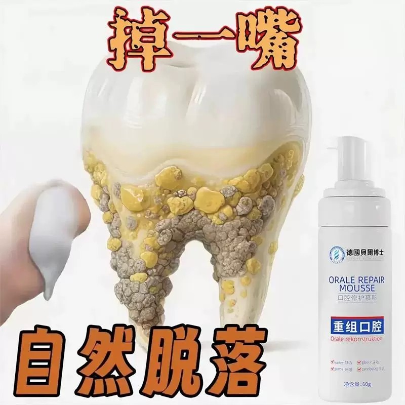 【德国专研】牙石溶解漱口水 去牙垢牙结石牙黄牙渍 口腔清洁神器