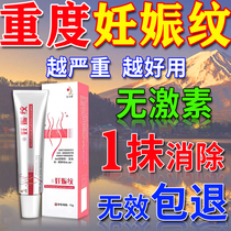 Stretch Marks Elimination Stretch Marks Firming Belly Scar Repair Cream Obesity Marks Growth Marks Stretch Marks Oil