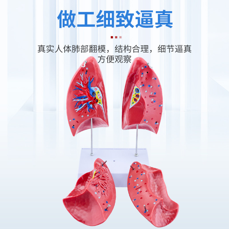 Human Organ Model Pathology Lung Larynx Cardiopulmonary Respiratory System Internal Organs Anatomical Structure Medical Teaching