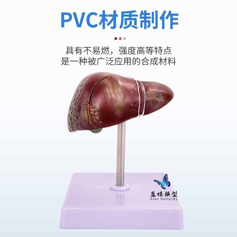 Teaching Simulation Model of Liver, Gallbladder, Pancreas, and Duodenum Structure, Digestive System Medical Liver, Pancreas, and Gallbladder Model