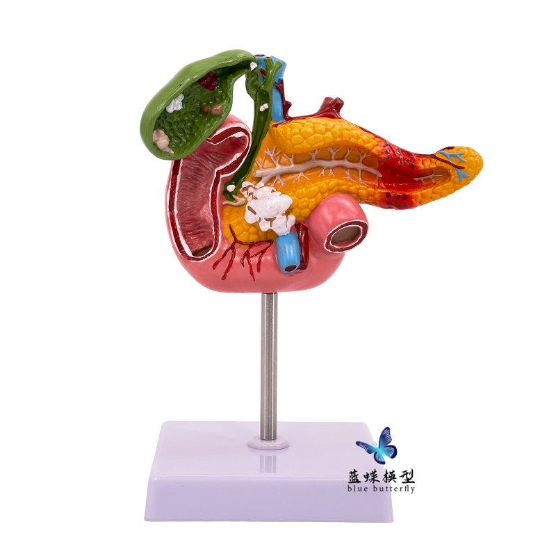 Teaching Simulation Model of Human Pancreas, Duodenum, Gallbladder Pathology, Gallstone Surgery, Digestive System Teaching Aids