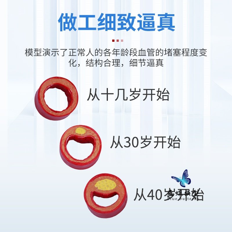 Human Cardiovascular Hierarchical Structure Anatomy Blockage Model Thrombosis Fat Pathology Arteriovenous Enlargement and Hardening Teaching Aids