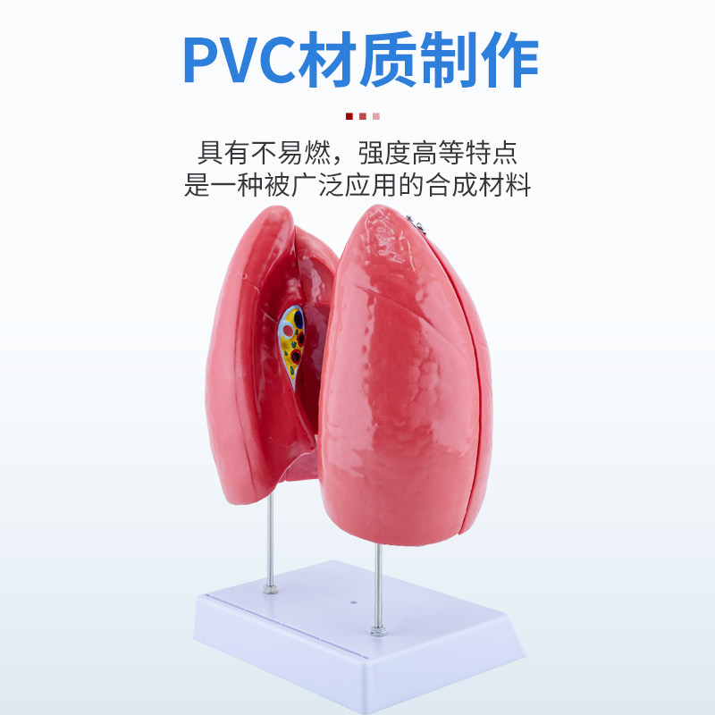 Human Organ Model Pathology Lung Larynx Cardiopulmonary Respiratory System Internal Organs Anatomical Structure Medical Teaching