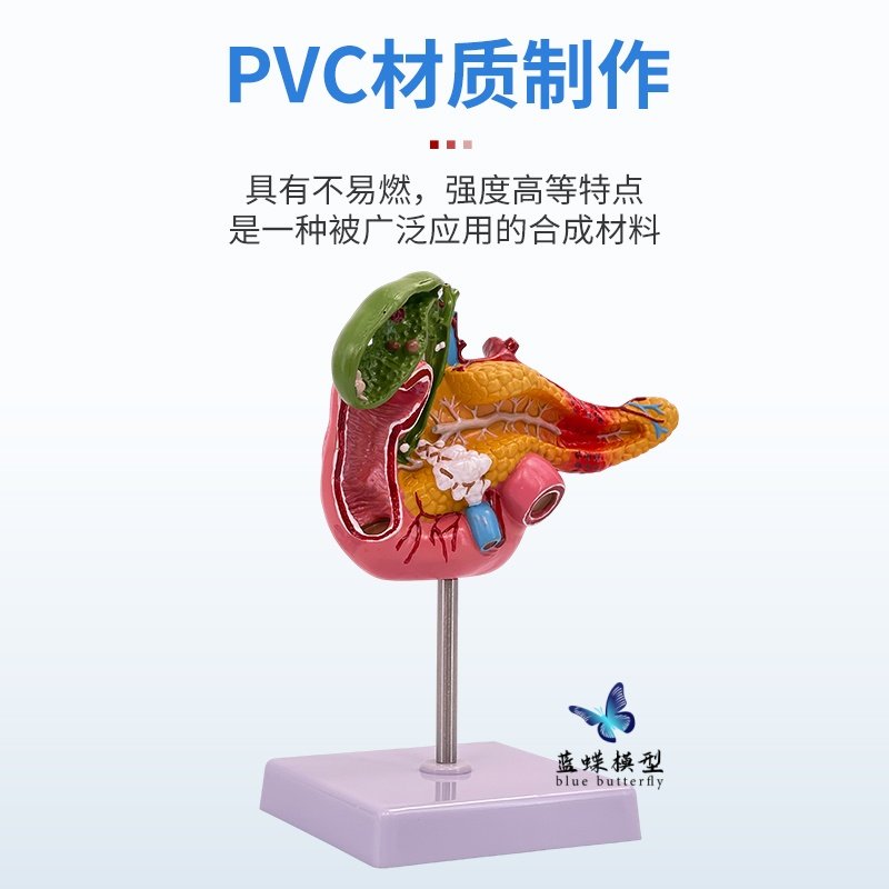 Teaching Simulation Model of Human Pancreas, Duodenum, Gallbladder Pathology, Gallstone Surgery, Digestive System Teaching Aids