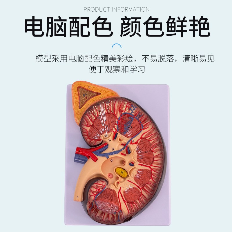 Human Kidney Model, Kidney Anatomy with Adrenal Gland Enlarged Model, Diseased Kidney, Human Internal Organ Anatomy