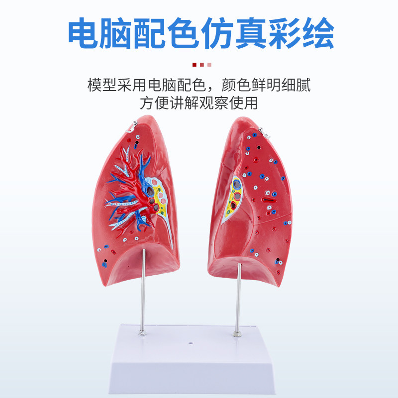 Human Organ Model Pathology Lung Larynx Cardiopulmonary Respiratory System Internal Organs Anatomical Structure Medical Teaching