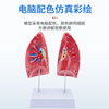Human Organ Model Pathology Lung Larynx Cardiopulmonary Respiratory System Internal Organs Anatomical Structure Medical Teaching