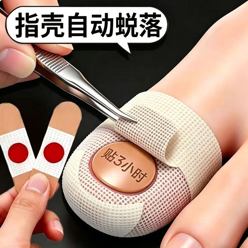 [Good Product Recommendation] Plant Extract Kills Bacteria [Genuine] Special Nail Stickers for Toes and Fingernails