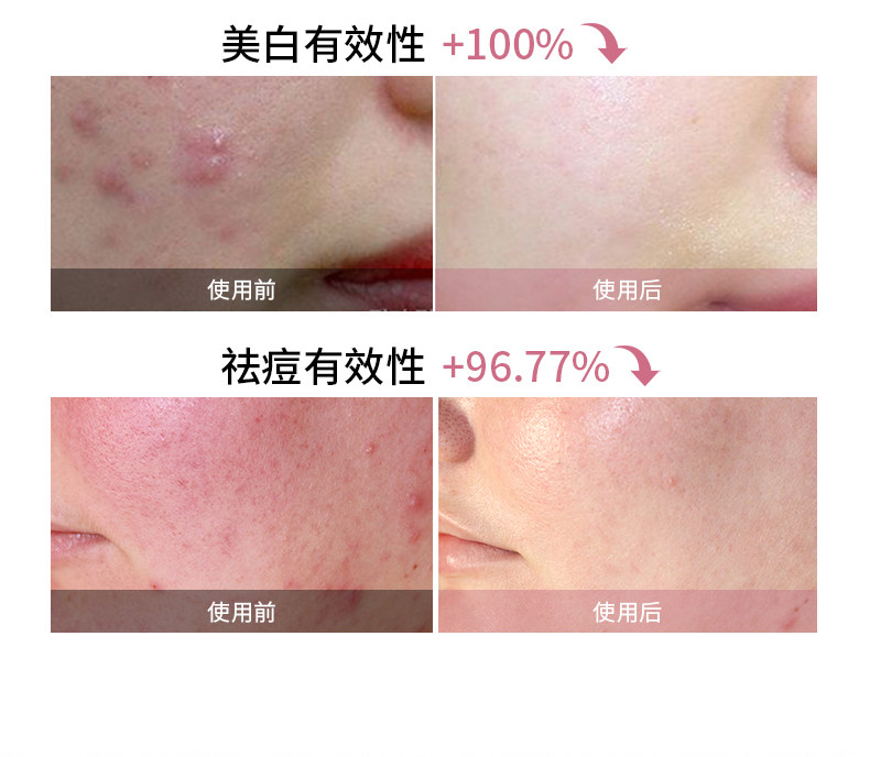 CARYA科光研粉色大排灯三折叠全身美白光疗光子嫩肤家用美容仪 CARYA科光研粉色大排灯三折叠全身美白光疗光子嫩肤家用美容仪