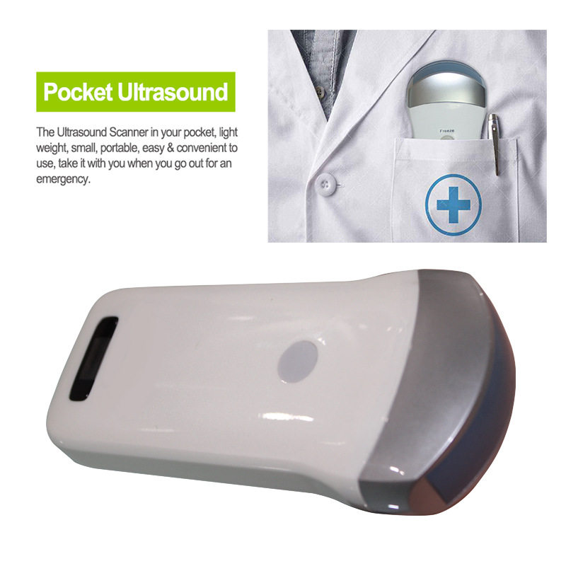 wireless probe type convex palm B/W ultrasound 跨境