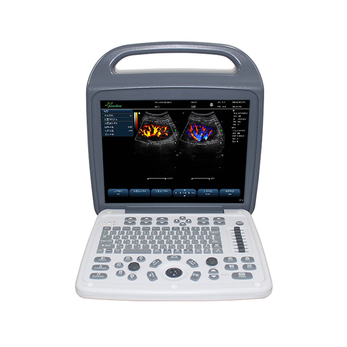 跨境专享Portable Color Doppler Ultrasound 15 inch screen