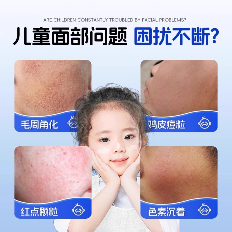 香港大药房的神奇药膏：治愈鸡皮肤困扰的福音