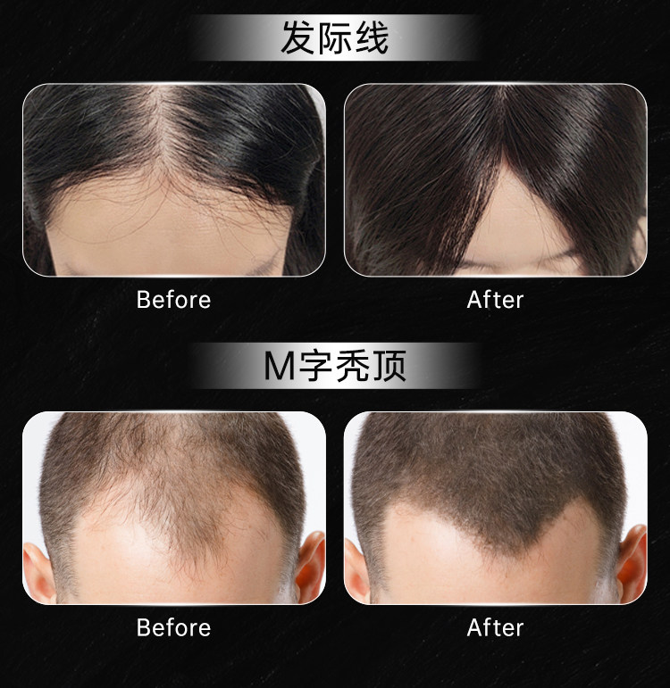 【中國直郵】 KEOPHIAL 防脫髮營養片 生物素維生素B6B7 360片/3瓶