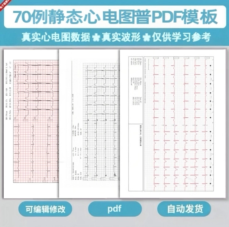 Static Ecg General Examination Form Pdf Electronic Version Template Package Ecg Image Question Bank Static Ecg General Examination Form Pdf Electronic Version Template Package Ecg Image Question Bank