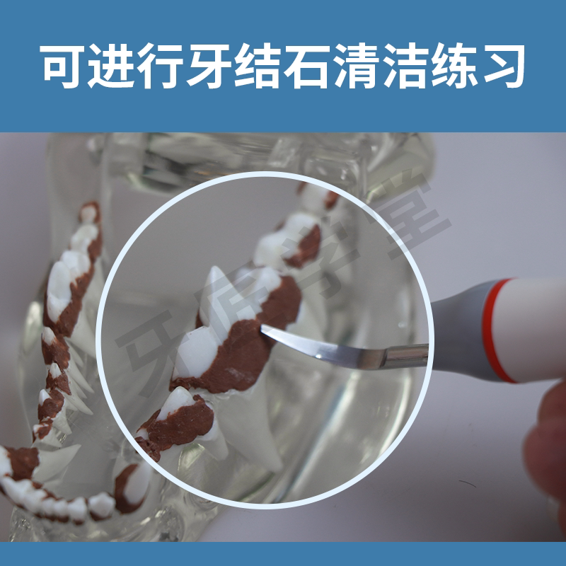 如何选择适合的教学用透明狗牙结石模型？-教学标本-淘宝百科网