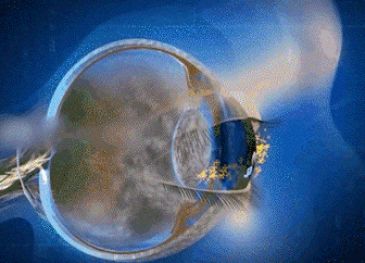 20260720_170504_071.gif