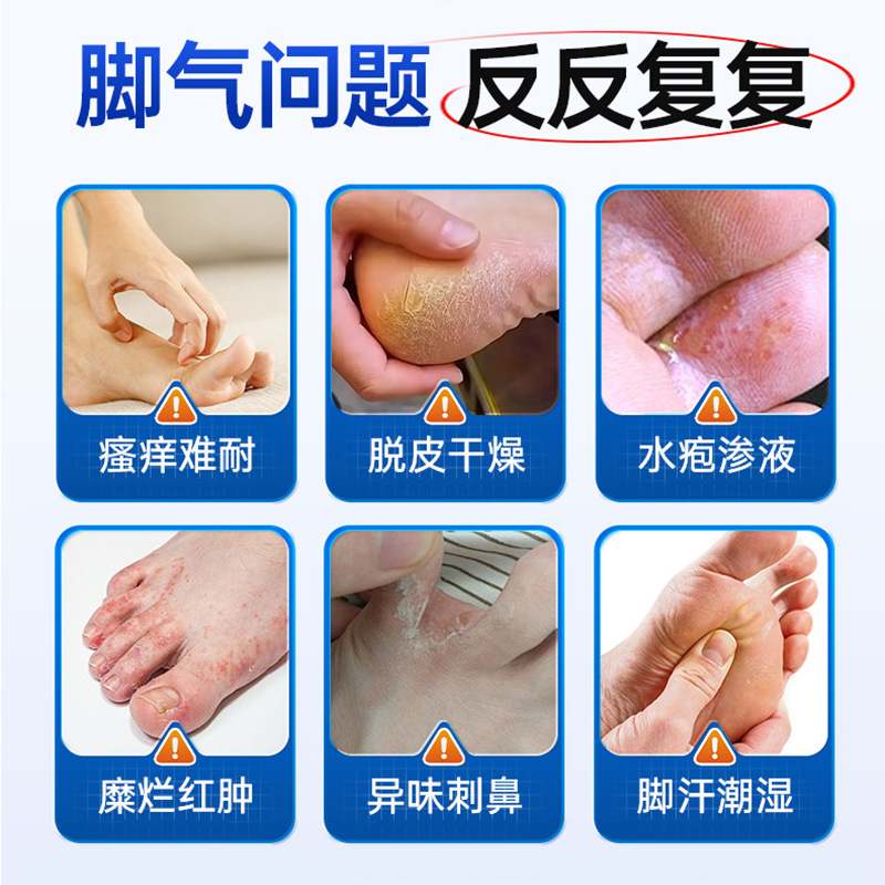 葵花脚气喷雾：足部健康守护者
