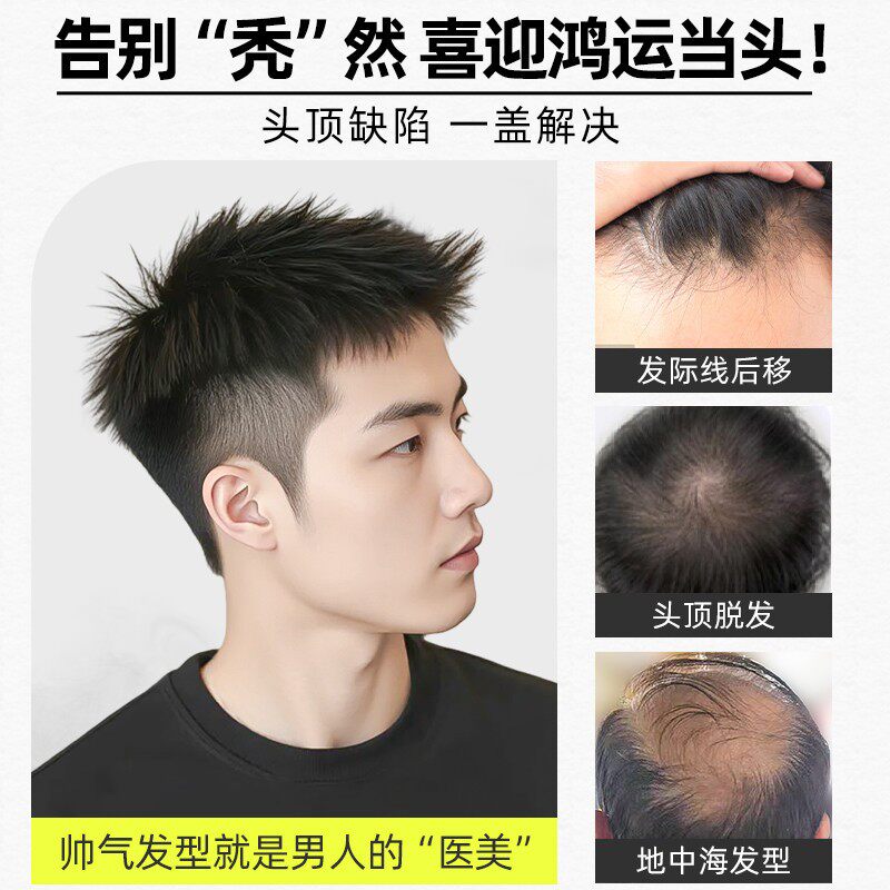 男士也能拥有自信发型!这顶美式前刺假发片太治愈了~_日常整顶假发_淘宝美妆网