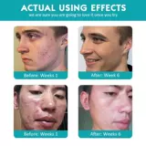 Межчатка кремовой пропроекв.