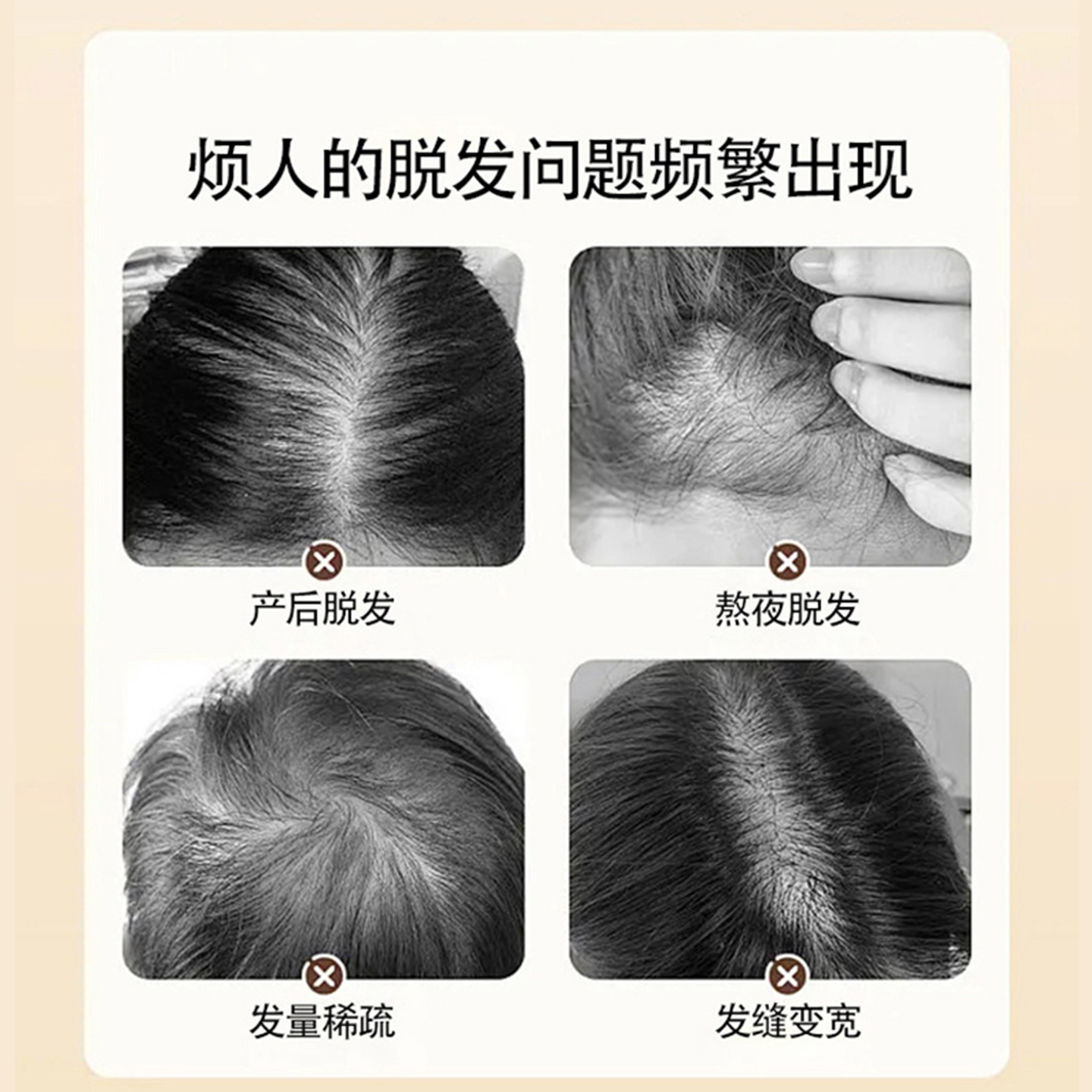 丝露杰防脱育发洗发露真能防脱吗?2025年实测效果全解析_头发护理_淘宝美妆网